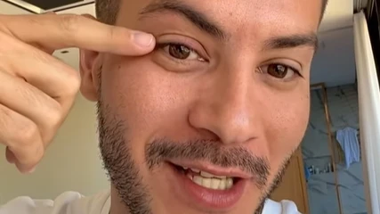 Arthur Aguiar usa leite materno para tentar curar terçol; médica explica que 