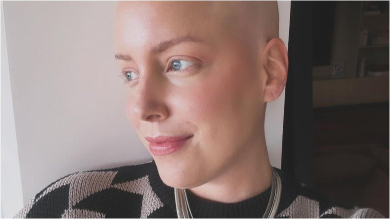 Fabiana Justus revela expectativa para crescimento do cabelo após câncer: ‘Curiosa’