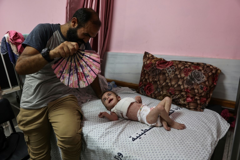 Sarna e piolho se propagam nas crianças em Gaza