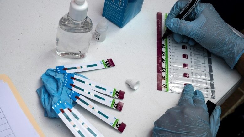 Testes rápidos de HIV | (Crédito: AFP/Arquivos)