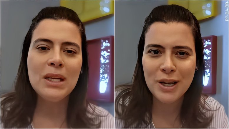 Michelle Loreto faz alerta em desabafo sobre doença autoimune: 'Pode se manifestar de diferentes maneiras’
