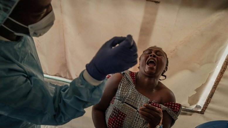 Casos de mpox crescem na República Democrática do Congo