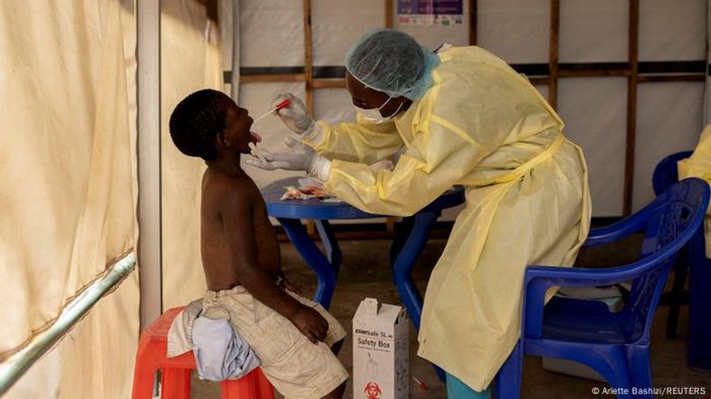 Suécia registra 1º caso de mpox fora da África após novo surto que fez OMS declarar emergência sanitária global