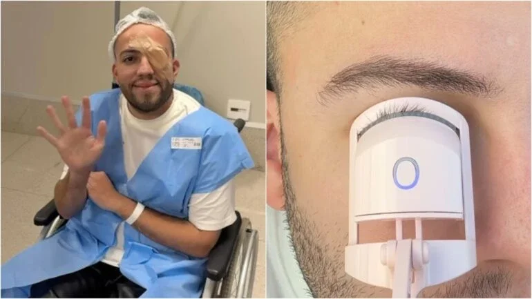 Conheça ‘terçol permanente’ que levou influencer a fazer cirurgia após uso de curvex