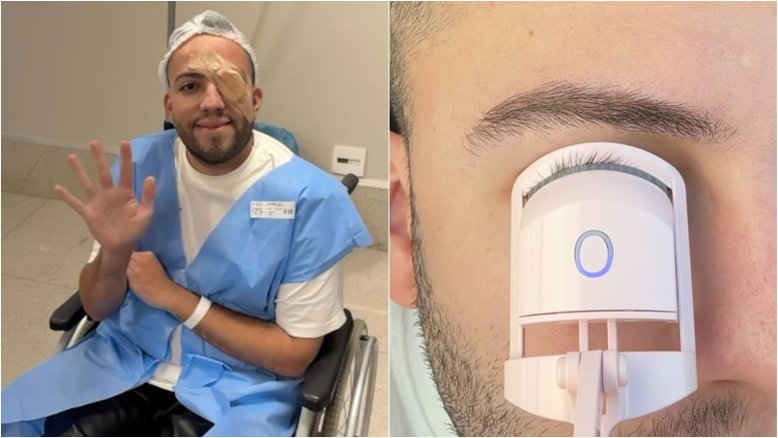 Conheça ‘terçol permanente’ que levou influencer a fazer cirurgia após uso de curvex