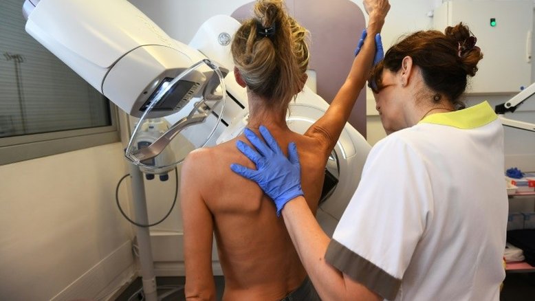 Aproximadamente uma em cada oito mulheres nos Estados Unidos será diagnosticada com câncer de mama invasivo ao longo da vida e uma em cada 43 vai morrer vítima da doença, segundo um estudo da Sociedade Americana do Câncer - AFP/Arquivos