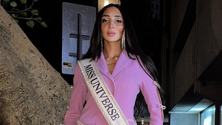 Após o diagnóstico de lúpus aos 8 anos, a modelo teve psoríase e vitiligo