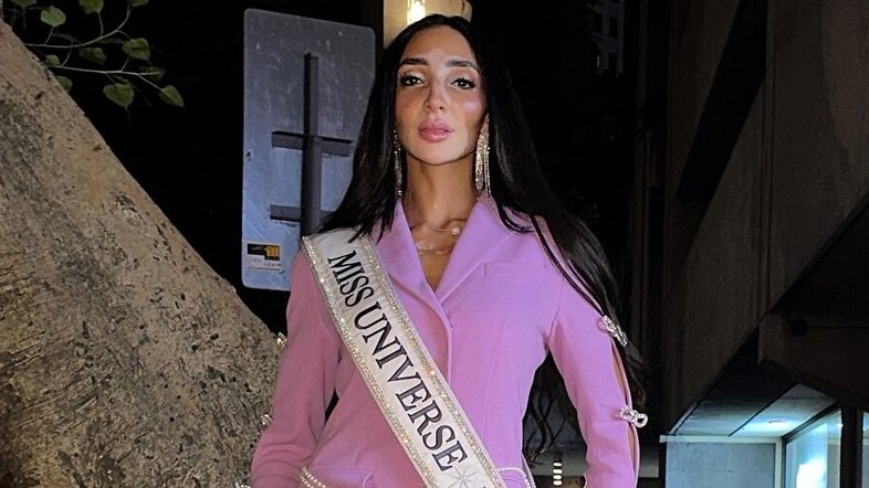 Após o diagnóstico de lúpus aos 8 anos, a modelo teve psoríase e vitiligo