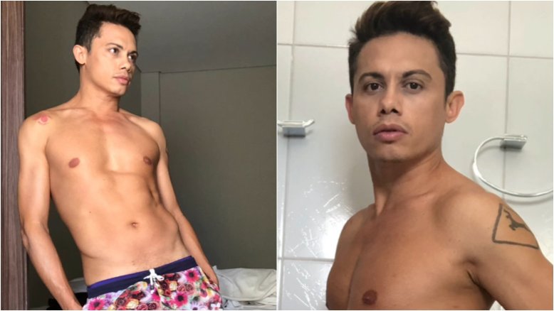 Glow News – Hipertensão arterial: entenda diagnóstico que fez Silvero Pereira fazer mudanças em sua rotina