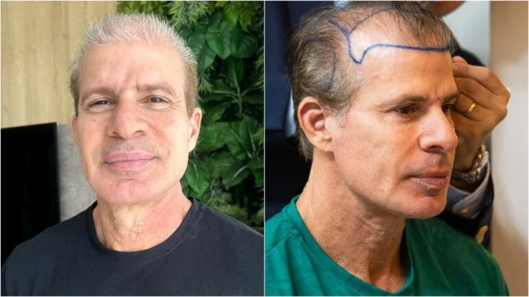 Túlio Maravilha encara transformação e surpreende ao apresentar antes e depois
