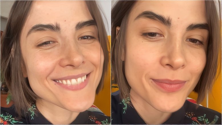 Maria Casadevall fala sobre cirurgia após descobrir síndrome rara: ‘Série de desconfortos’
