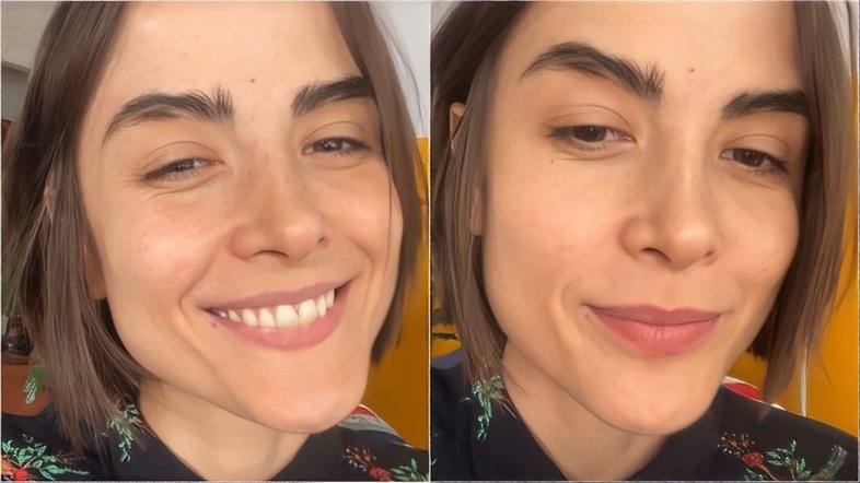 Maria Casadevall fala sobre cirurgia após descobrir síndrome rara: ‘Série de desconfortos’