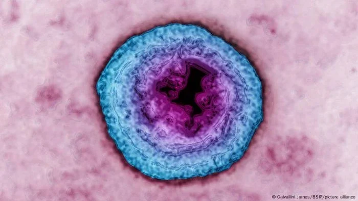 OMS: 1 em cada 5 adultos tem herpes genital