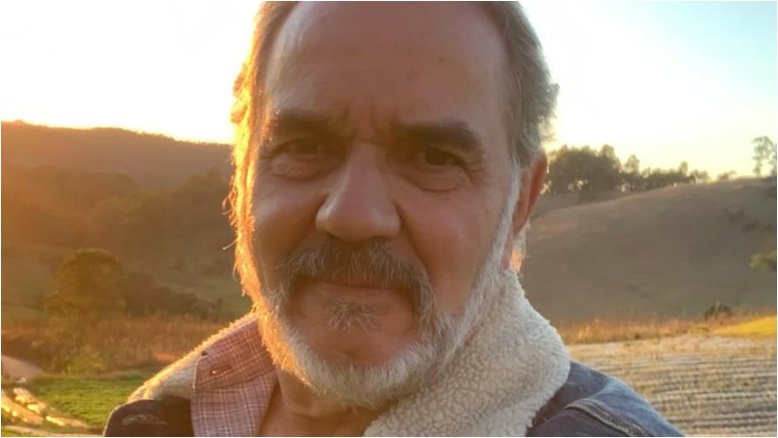 Humberto Martins apresenta resultado de harmonização facial; confira o antes e depois