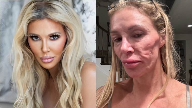 Ex-modelo internacional pede ajuda após rosto 'derreter': 'O que está acontecendo?'