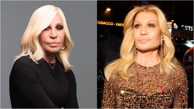 Novo rosto de Donatella Versace surpreende fãs após ‘combo rejuvenescedor’