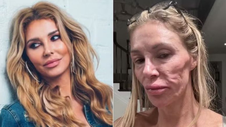 Reprodução/Instagram