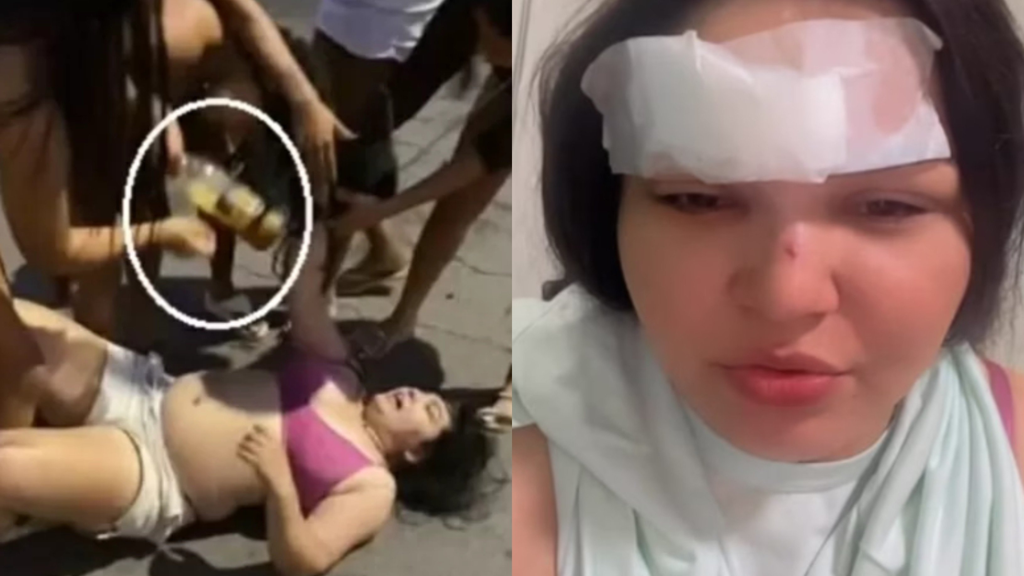 Cantora é agredida brutalmente com garrafa de vidro no Ceará 2 Cantora é agredida brutalmente com garrafa de vidro no Ceará