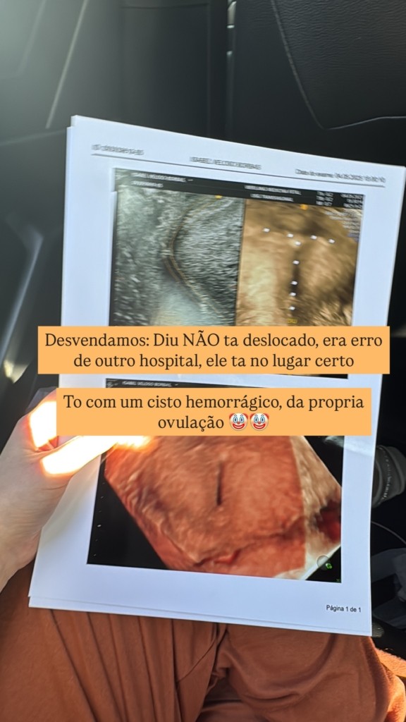 Isabel Veloso compartilha novo diagnóstico após dores intensas: 'Cisto hemorrágico' 1 Isabel Veloso compartilha novo diagnóstico após dores intensas: 'Cisto hemorrágico'