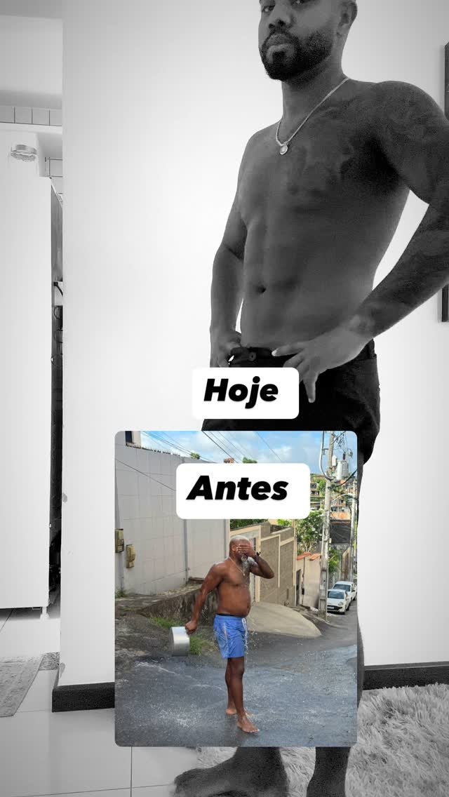 Ex-BBB Davi Brito mostra abdômen após realizar lipo HD