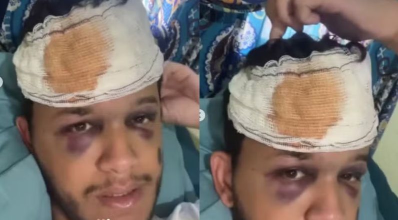 Cantor sofre acidente em rodovia e mostra ferimentos de traumatismo craniano 2 Cantor sofre acidente em rodovia e mostra ferimentos de traumatismo craniano