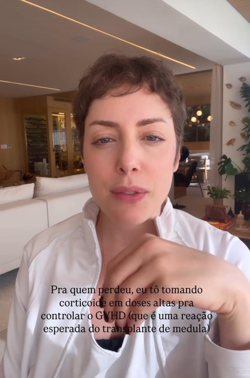 Fabiana Justus revela consequência de reação ao transplante de medula 5 Fabiana Justus revela consequência de reação ao transplante de medula