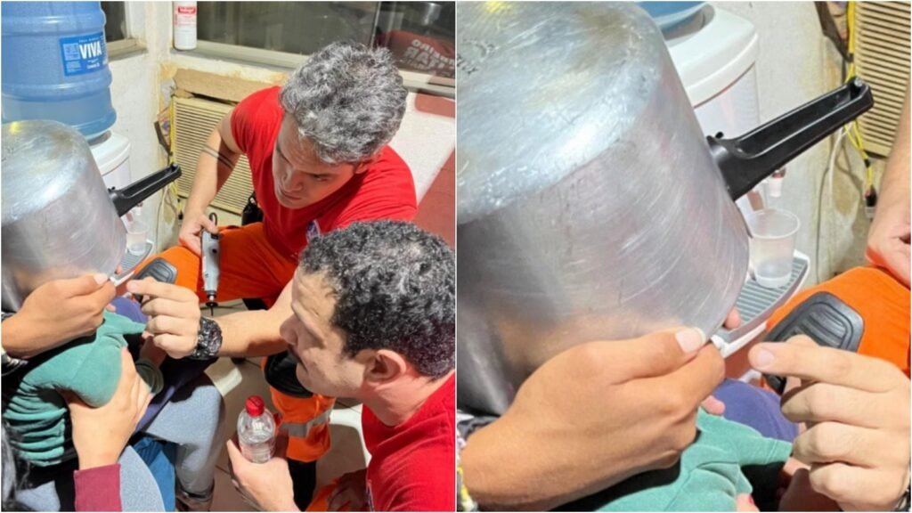Criança de 2 anos é socorrida com panela de pressão presa na cabeça em MG 2 Criança de 2 anos é socorrida com panela de pressão presa na cabeça em MG