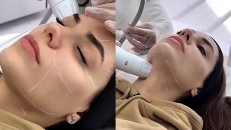 Jade Magalhães realiza procedimento estético