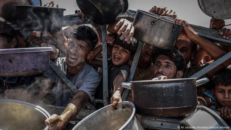 ONU: 20% das crianças na Cidade de Gaza estão desnutridas