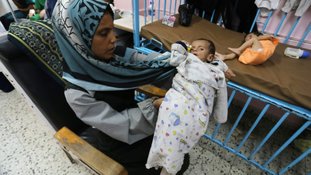 Organizações humanitárias alertam sobre desnutrição infantil em Gaza