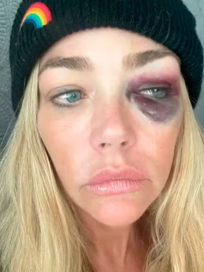 Vídeo de reality show mostra marido ameaçando Denise Richards; assista