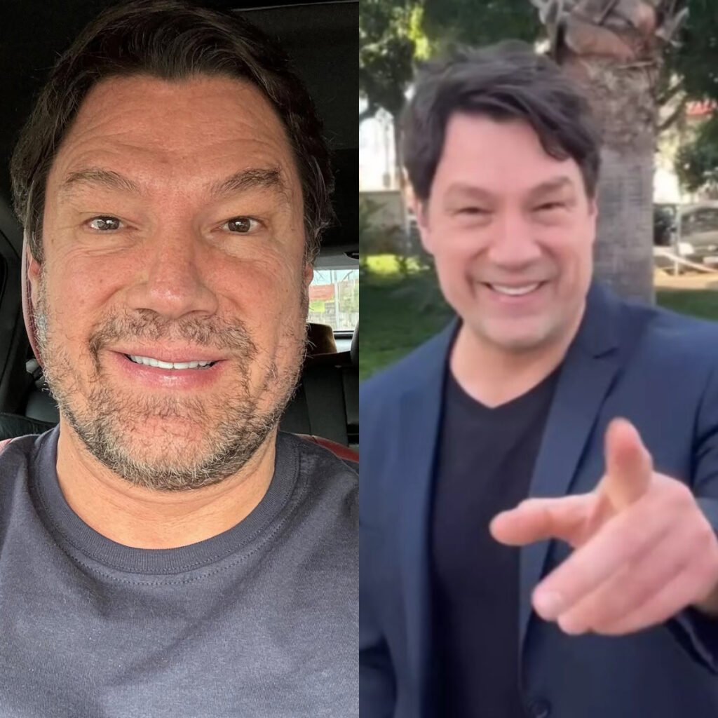 Ricardo Macchi, o 'cigano Igor', passa por harmonização facial; veja antes e depois 2 Ricardo Macchi, o 'cigano Igor', passa por harmonização facial; veja antes e depois