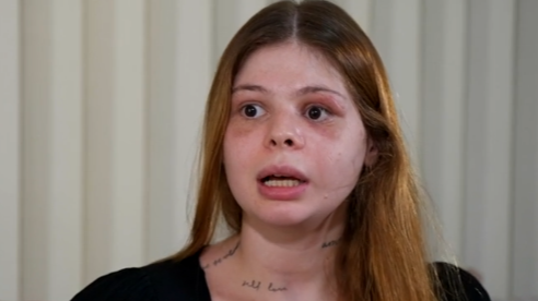Médica que teve rosto desfigurado pelo namorado fala sobre ataque