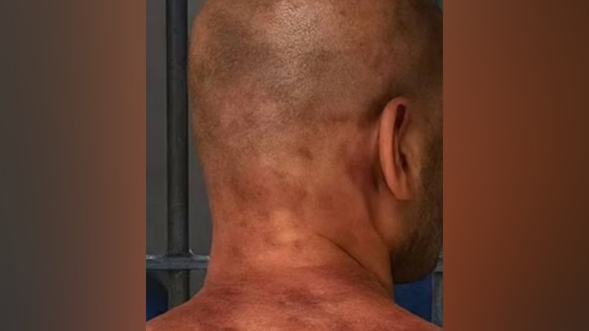 Homem preso por dar 60 socos na namorada diz ter sido agredido na prisão; veja foto 2 Homem preso por dar 60 socos na namorada diz ter sido agredido na prisão; veja foto