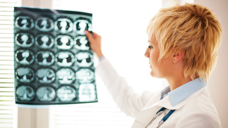 Médica checa tomografia cerebral