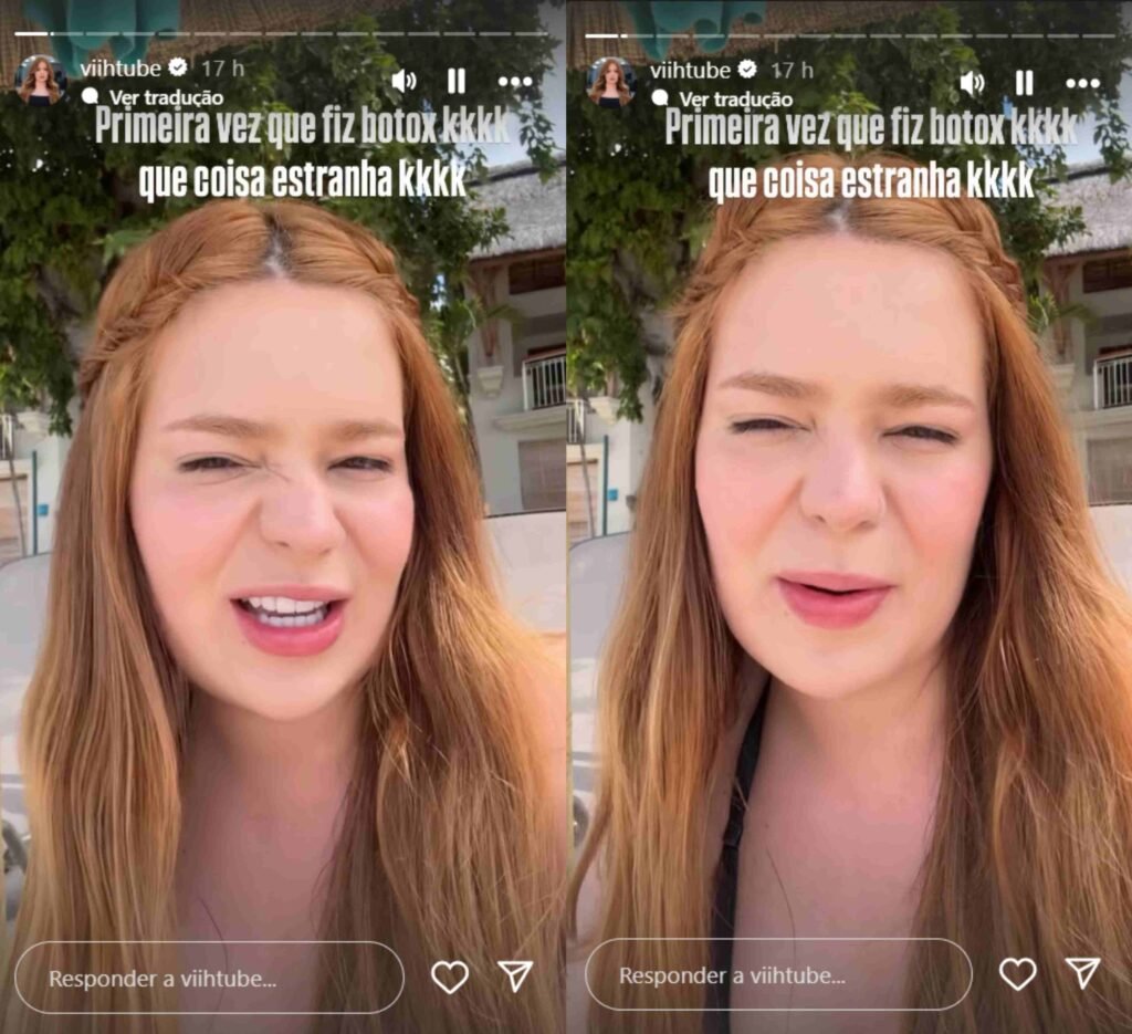 Viih Tube se queixa após aplicar botox pela primeira vez: ‘Não consigo ter expressão’ 2 Viih Tube se queixa após aplicar botox pela primeira vez: ‘Não consigo ter expressão’