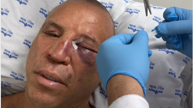 Wanderlei teve nariz quebrado durante briga, diz amigo