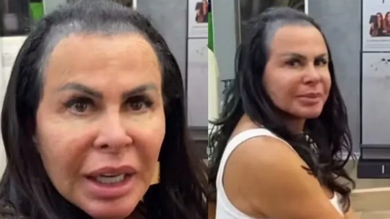 Gretchen sobre luta contra alopecia: 'Não tenho mais cabelo'
