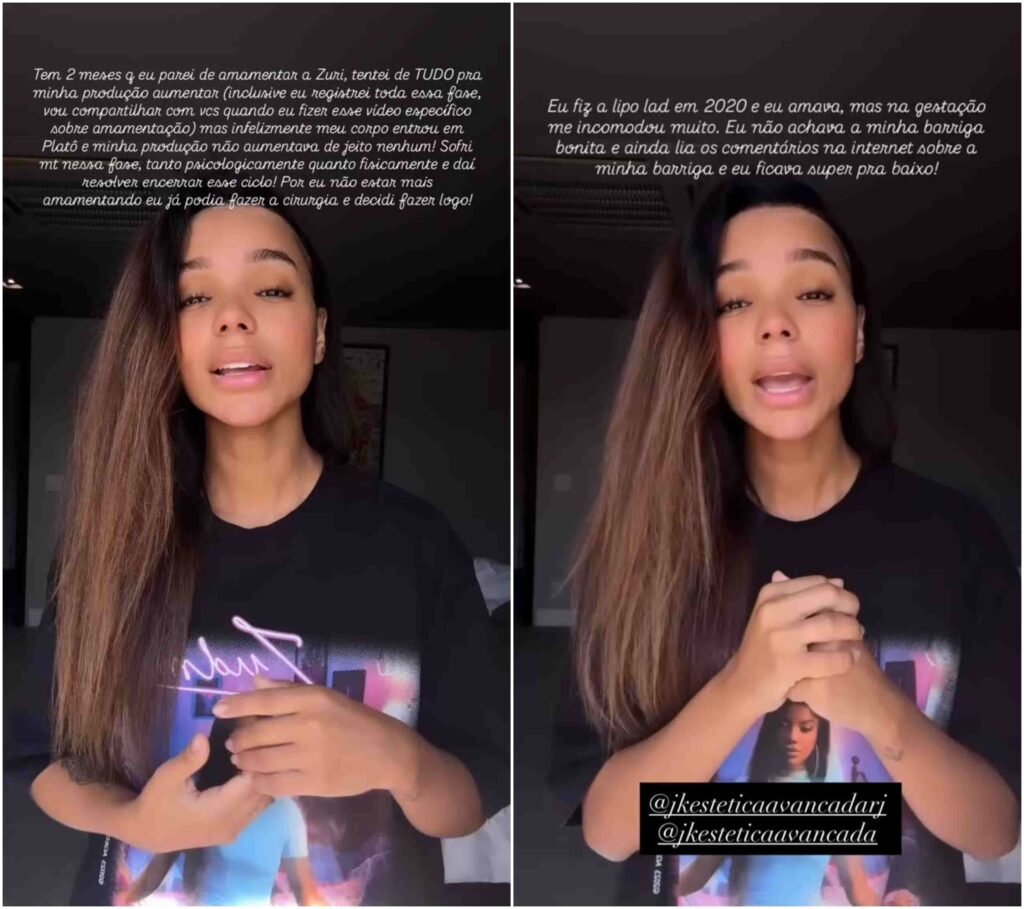 Brunna Gonçalves faz cirurgia estética meses após dar à luz: 'Começou a me incomodar' 2 Brunna Gonçalves faz cirurgia estética meses após dar à luz: 'Começou a me incomodar'