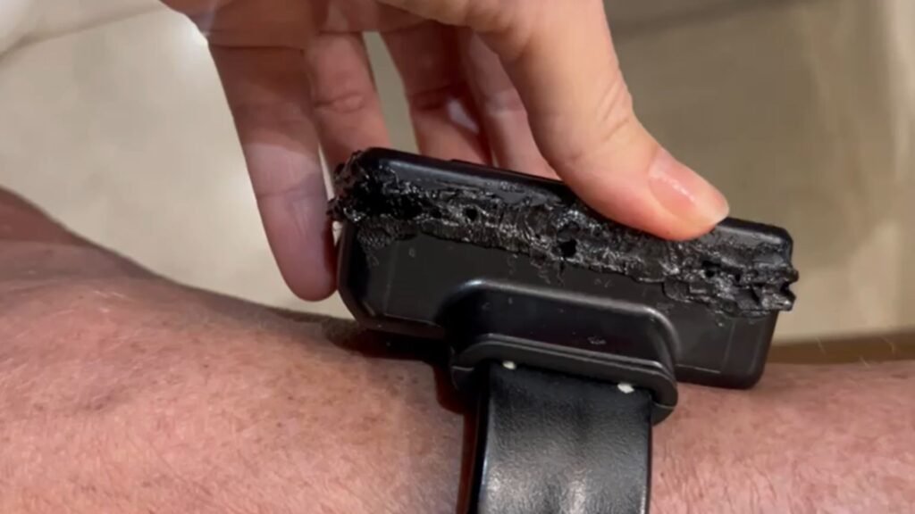 Como ficou a tornozeleira eletrônica de Bolsonaro após tentativa de violação 