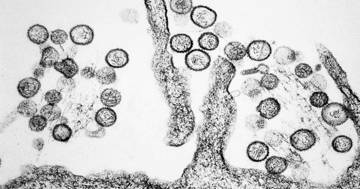 Governo da Itália descarta risco de pandemia de hantavírus: ‘Não é Covid’