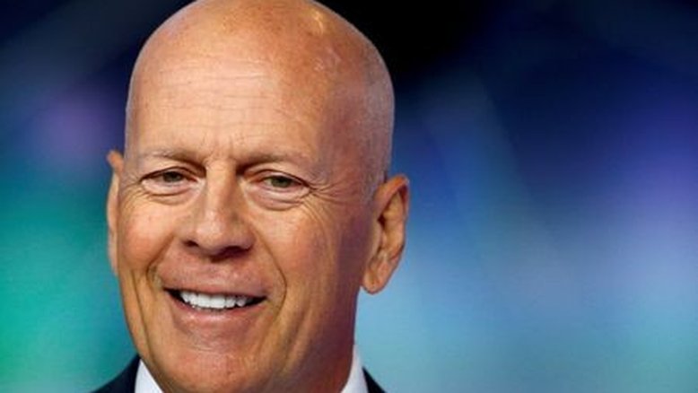 Ator Bruce Willis é diagnosticado com demência