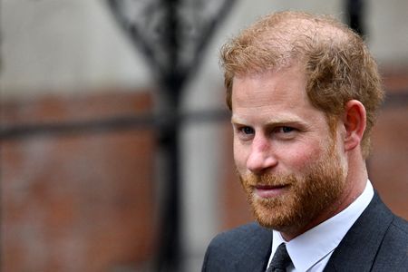 Príncipe Harry pode estar ficando careca devido ao estresse, diz especialista