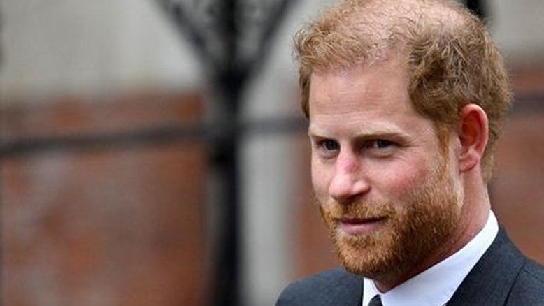 Príncipe Harry pode estar ficando careca devido ao estresse, diz especialista