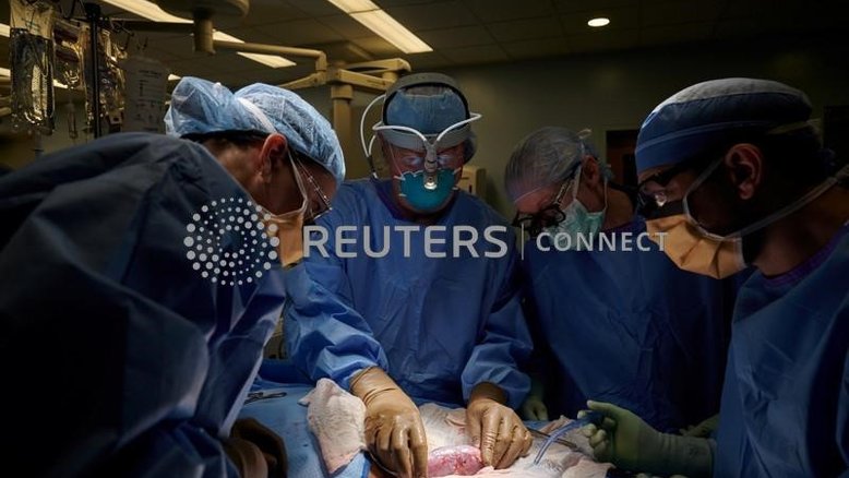 Cirurgiões dos EUA testam com sucesso transplante de rim de porco em humano
