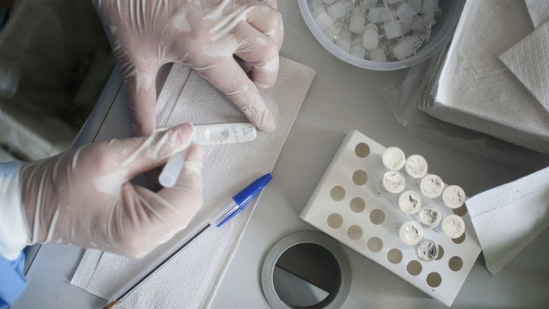 Brasil registra 66.583 novos casos e 428 novas mortes por Covid-19, diz ministério