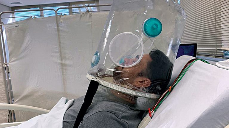 BOLHA DE OXIGÊNIO  São Paulo  Capacete cria uma “bolha” para que paciente consiga respirar sem precisar ser intubado
