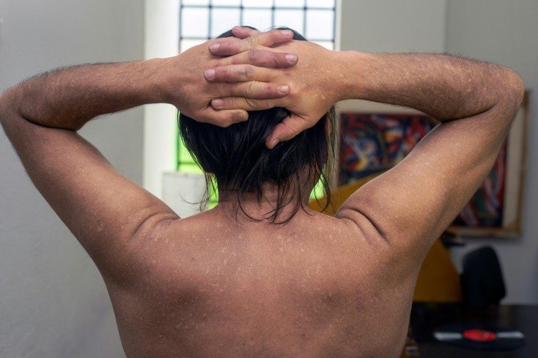Narcodoenças na Colômbia, a sequela silenciosa no maior produtor de cocaína Narcodoenças na Colômbia, a sequela silenciosa no maior produtor de cocaína