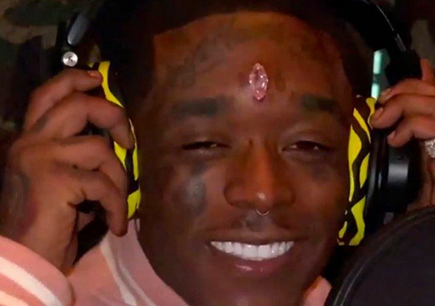 Diamante de R$ 120 milhões implantado na testa de rapper é arrancado em show