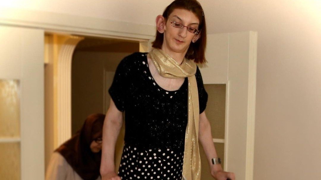Guiness registra que turca de 24 anos é a mulher mais alta do mundo Guiness registra que turca de 24 anos é a mulher mais alta do mundo